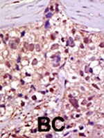 PAB1772 - UBE1 / UBA1