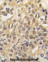 PAB1772 - UBE1 / UBA1