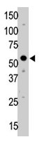 PAB1774 - UBA3 / UBE1C