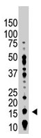 PAB1776 - UBE2B / RAD6B