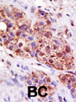 PAB1776 - UBE2B / RAD6B