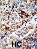 PAB1834 - USP21