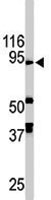 PAB1843 - AOF2