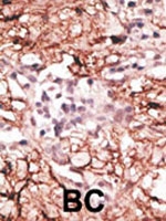 PAB1843 - AOF2