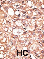 PAB1844 - AOF2