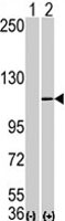 PAB1844 - AOF2