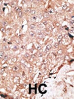 PAB1845 - AOF2