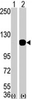 PAB1845 - AOF2