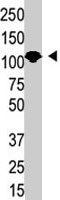 PAB1849 - SENP6