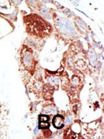 PAB1849 - SENP6