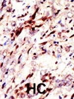 PAB1859 - SUMO3 / SMT3A