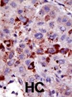 PAB1860 - SUMO1