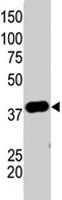 PAB1860 - SUMO1