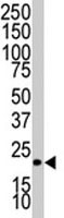 PAB1861 - Bcl-2-like 11