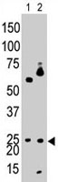 PAB1863 - BNIP3L / BNIP3A