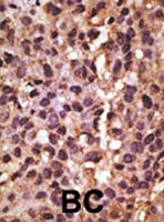 PAB1863 - BNIP3L / BNIP3A