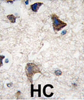 PAB1864 - Cadherin-4