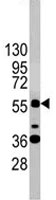 PAB1865 - SOX9