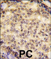 PAB1865 - SOX9