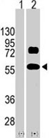 PAB1865 - SOX9