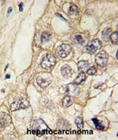 PAB1867 - Cadherin-6
