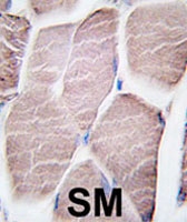 PAB1876 - Glycogen phosphorylase muscle form