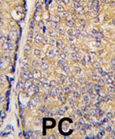 PAB1880 - STAP1 / BRDG1