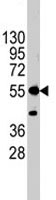 PAB1882 - Alkaline phosphatase / ALPI / IAP
