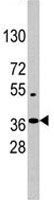PAB1886 - NANOG