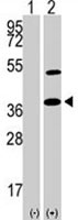 PAB1886 - NANOG