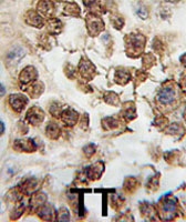 PAB1887 - NANOG