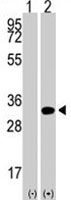 PAB1887 - NANOG
