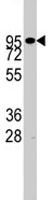 PAB1888 - CD156b / ADAM17