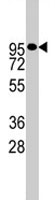 PAB1889 - CD156b / ADAM17
