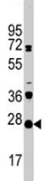PAB1890 - CD3 gamma chain