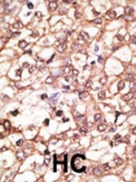 PAB1891 - Kremen protein 1