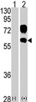 PAB1891 - Kremen protein 1