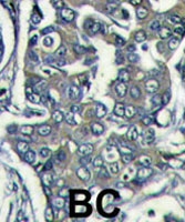 PAB1899 - EIF4E2 / EIF4EL3