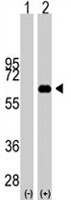 PAB1903 - c-Myc