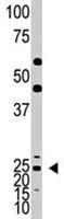 PAB1911 - ASCL1