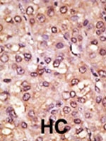 PAB1911 - ASCL1