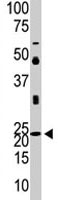 PAB1912 - Neurogenin 1