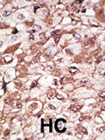 PAB1912 - Neurogenin 1