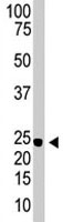 PAB1916 - Neurogenin-3