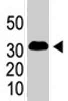 PAB1924 - SNAI1