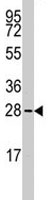 PAB1927 - SNAI1