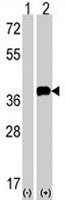 PAB1927 - SNAI1