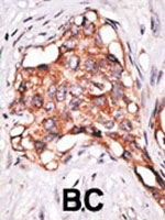 PAB1928 - GDF3