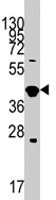 PAB1929 - GDF3