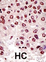 PAB1930 - UBE4B
